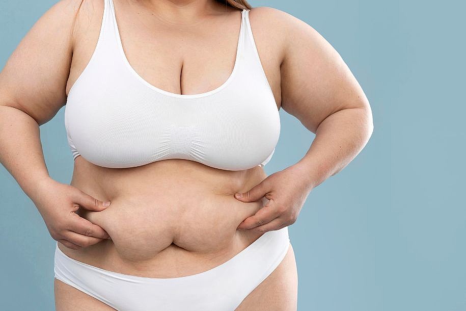 Obesidade: qual é a sua relação com a saúde do coração?
